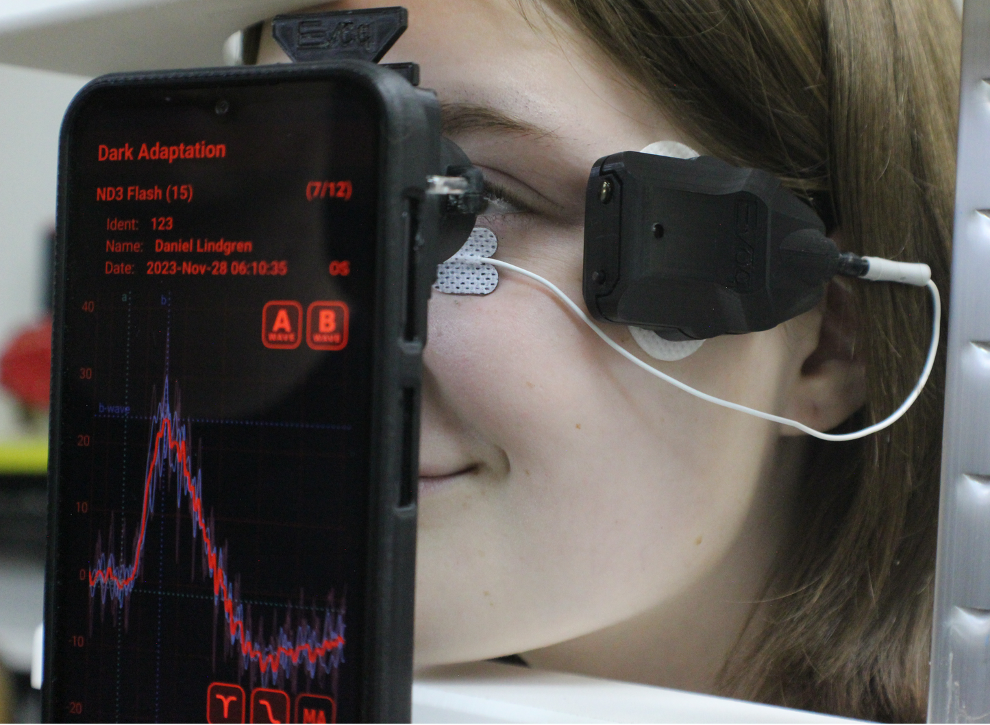 SmartERG R - Available now for Investigational Research