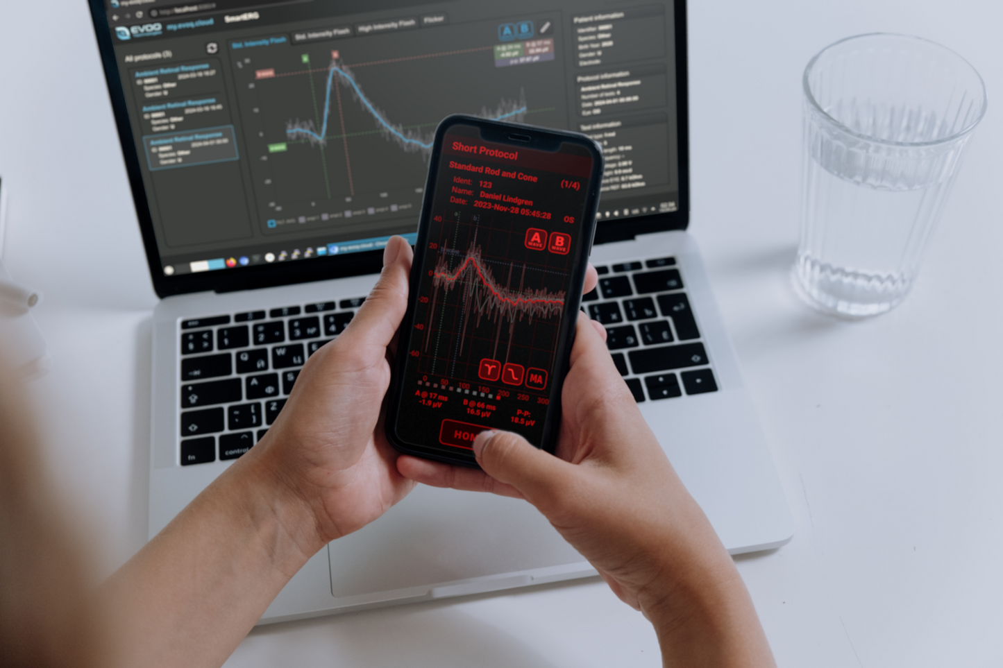 SmartERG R - Available now for Investigational Research